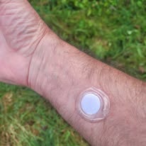 Anwendung der Biophotonenpflaster